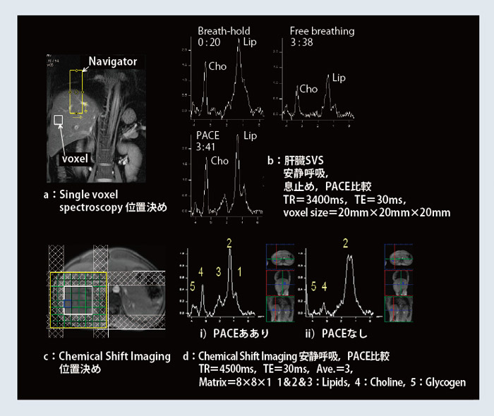 }3@2D PACEp SpectroscopyiW.I.P.j