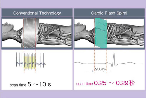 }2@Flash Cardio Spiral Mode