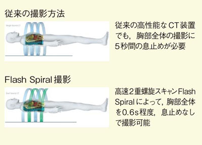 }1@High Pitch Double Spiral Scan