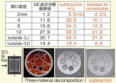 }5@Three-material decompositionsubtraction̔r