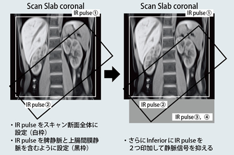 }5@喬̃XLv̐ݒ@