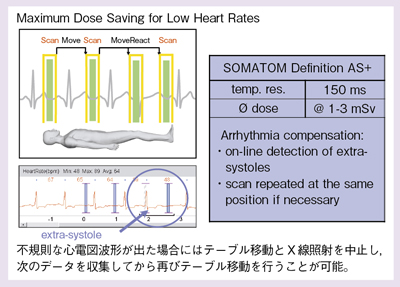 }1@RxViSBe[h Adaptive Cardio Sequence