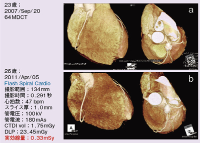 }1@RxViSBe[h Adaptive Cardio Sequence