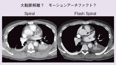 }4@Flash Spiralɂ郂[VA[`t@Ngyʂ̌