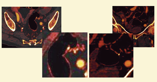 }9@Ǘ3F75uhiodine imageiSAFIREpj