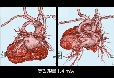 }2@}1VR摜 pO̐SJe[e͎{sĂȂB
