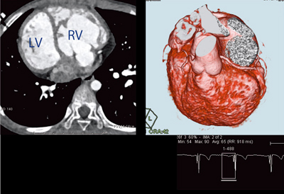 }7@Ǘ2F8΁CCC匌Ǔ]iFlash Spiral Cardioj
