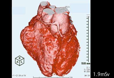 }8@Ǘ3F8΁CjCS匌Ǔ]{哮kǂ̏pVR摜iFlash Spiral Cardioj