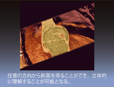 }4@ٕsSǂ4DCT摜