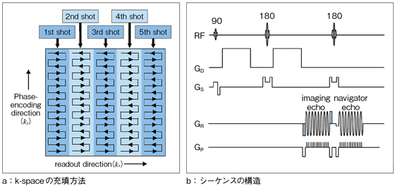 }1@syngo RESOLVẼf[^WƃV[PX1j