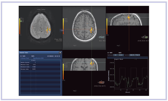 }18@fMRI