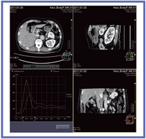 }3@CT perfusion͉̉