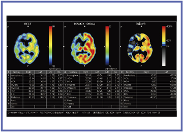 }6@NEURO FLEXER ver.10p]z\\]iEICǗj