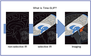 }3@Time-SLIP@ɂCSF`ǒ
