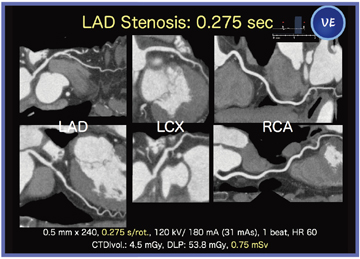 }2@Ǘ2FLADstenosis