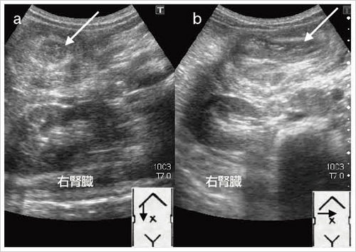 }6@dϏtarget signiajpseudokidney signibj