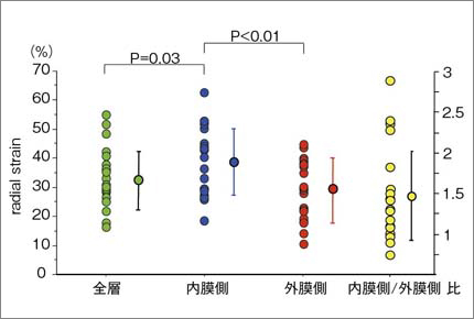 }2@̒Oǒuradial strain