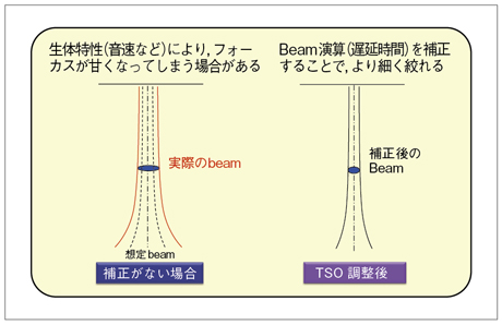 }4@TSOiTissue Spesific Optimizationǰ