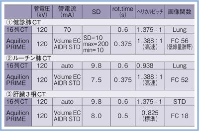 \1@@ɂCT̎Be