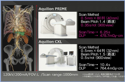 }8@Aquilion CXLAquilion PRIME̎BeԁE΂ʂ̔r