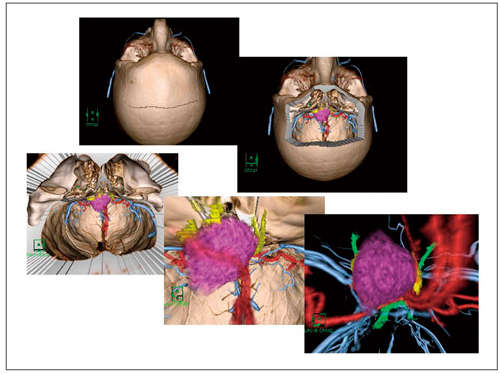 }2@ƌߕpO3D-multifusion imageR}