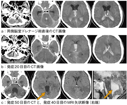 }2@CTo߂MRI