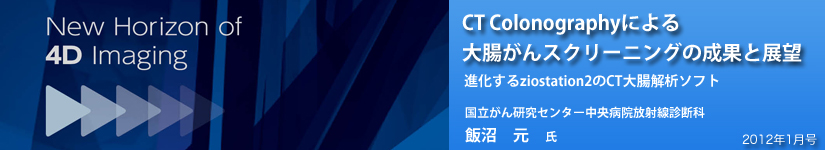 CT Colonographyɂ咰XN[jO̐ʂƓW]@iziostation2CT咰̓\tg@񌤋Z^[a@ːffȁ@я@ 