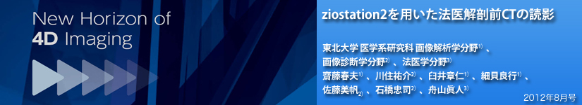 ziostation2p@UOCT̓ǉe