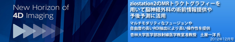 ziostation2MRgNgOtB[pĔ]_oOȂ̏pO񋟂\\Ɋp@}`_eBȃt[W⎩Rx̍ROIoɂ荂쐫
